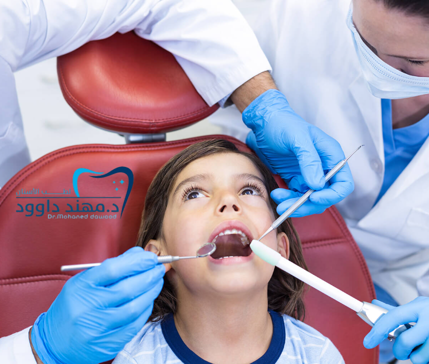 تنظيف الأسنان للاطفال عند الطبيب: 0545378843