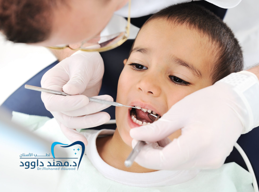 تنظيف الأسنان للاطفال عند الطبيب: 0545378843