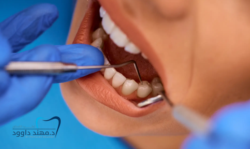 تجربتي مع الحشوات التجميلية: 0545378843