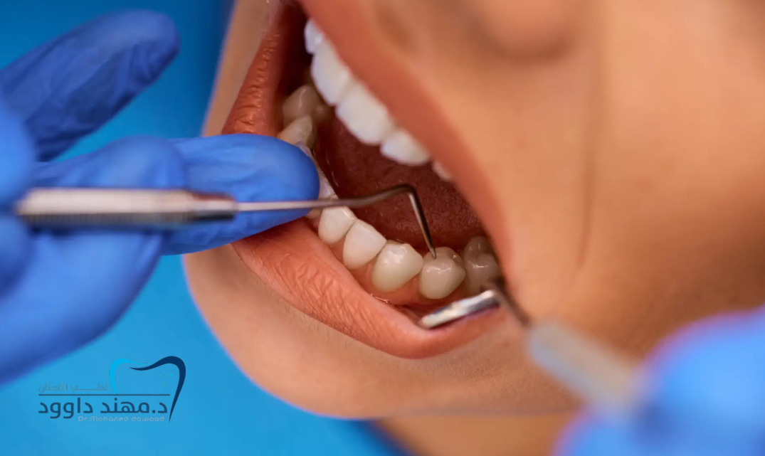 تجربتي مع الحشوات التجميلية: 0545378843