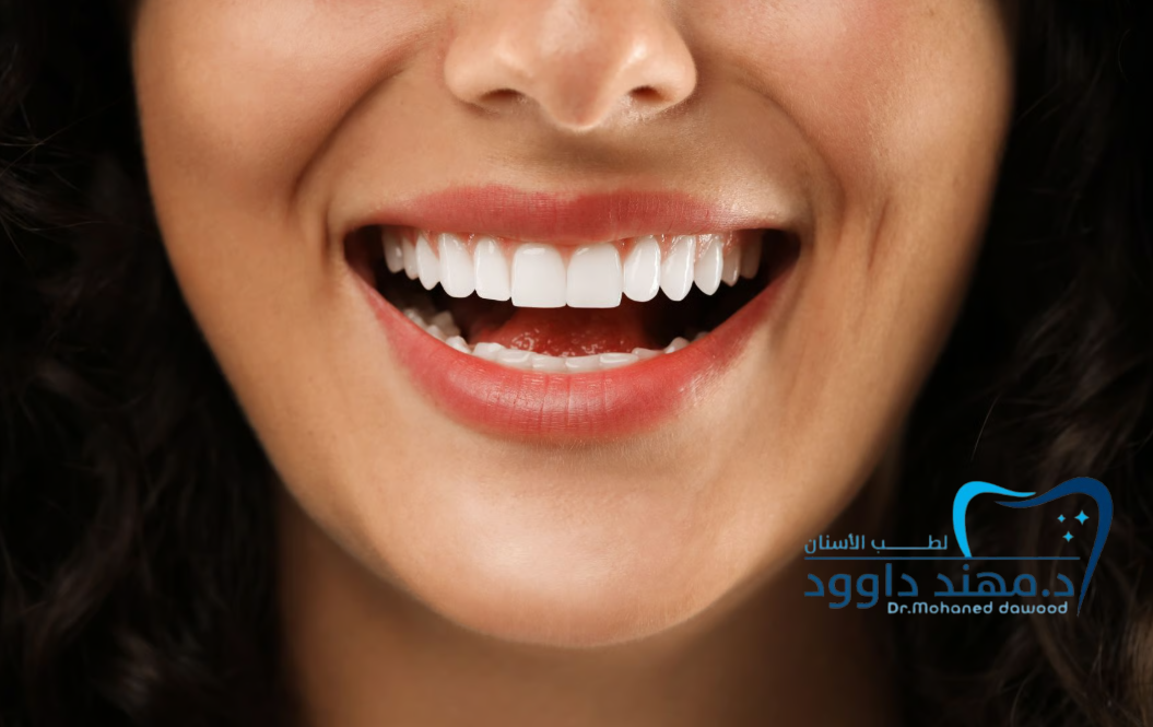ابتسامة هوليود المتحركة سعرها في السعودية وأهم مميزاتها: 0545378843