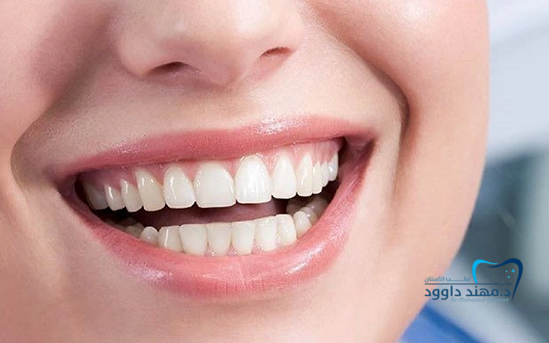 تبييض الأسنان بالليزر كم جلسة: 0545378843