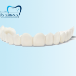 ابتسامة هوليود المتحركة سناب اون سمايل: 0545378843