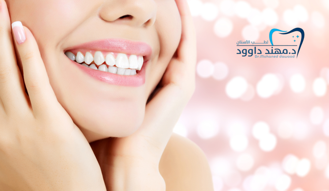 ابتسامة هوليود للأسنان الصفراء والمتصبغة: 0545378843