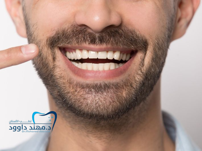 احصل على ابتسامة المشاهير - عروض ابتسامة هوليود السعودية