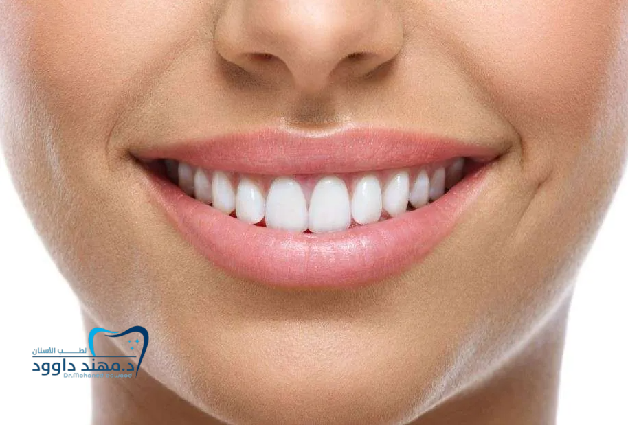 ابتسامة هوليود 20 سن: 0545378843