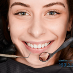 أسعار فينير الأسنان في السعودية 2026: 0545378843